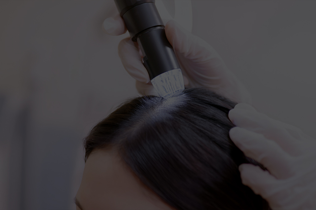 Scalp Care